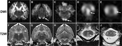 Case Report: MRI, Clinical, and Pathological Correlates of Bromethalin Toxicosis in Three Dogs